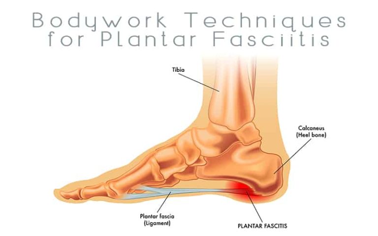 Bodywork Techniques for Plantar Fasciitis | Massage Professionals Update