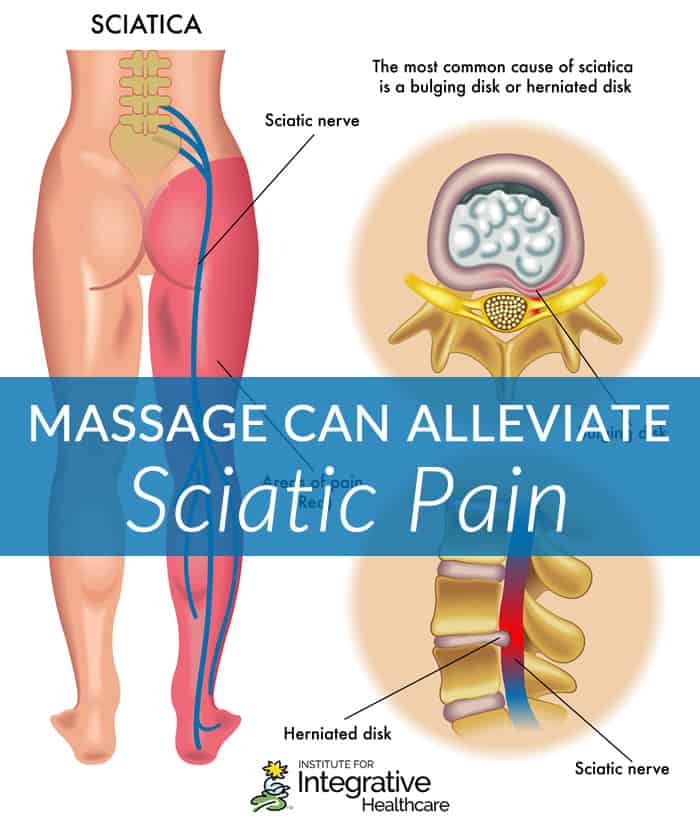Massage Therapy For Sciatica Pain - Your Ultimate Guide to Pain