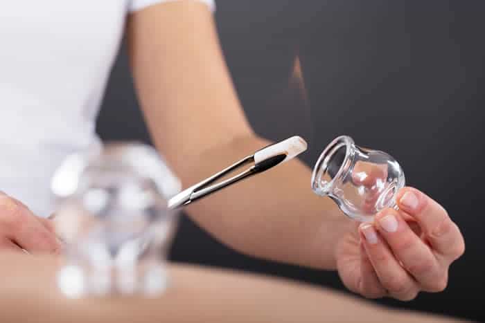 In Arizona, fire cupping is under the scope of practice of acupuncturists but not for massage therapists.